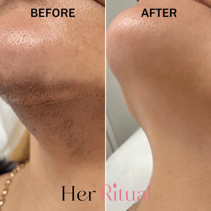 Her Ritual - Hair Inhibitor Oil™