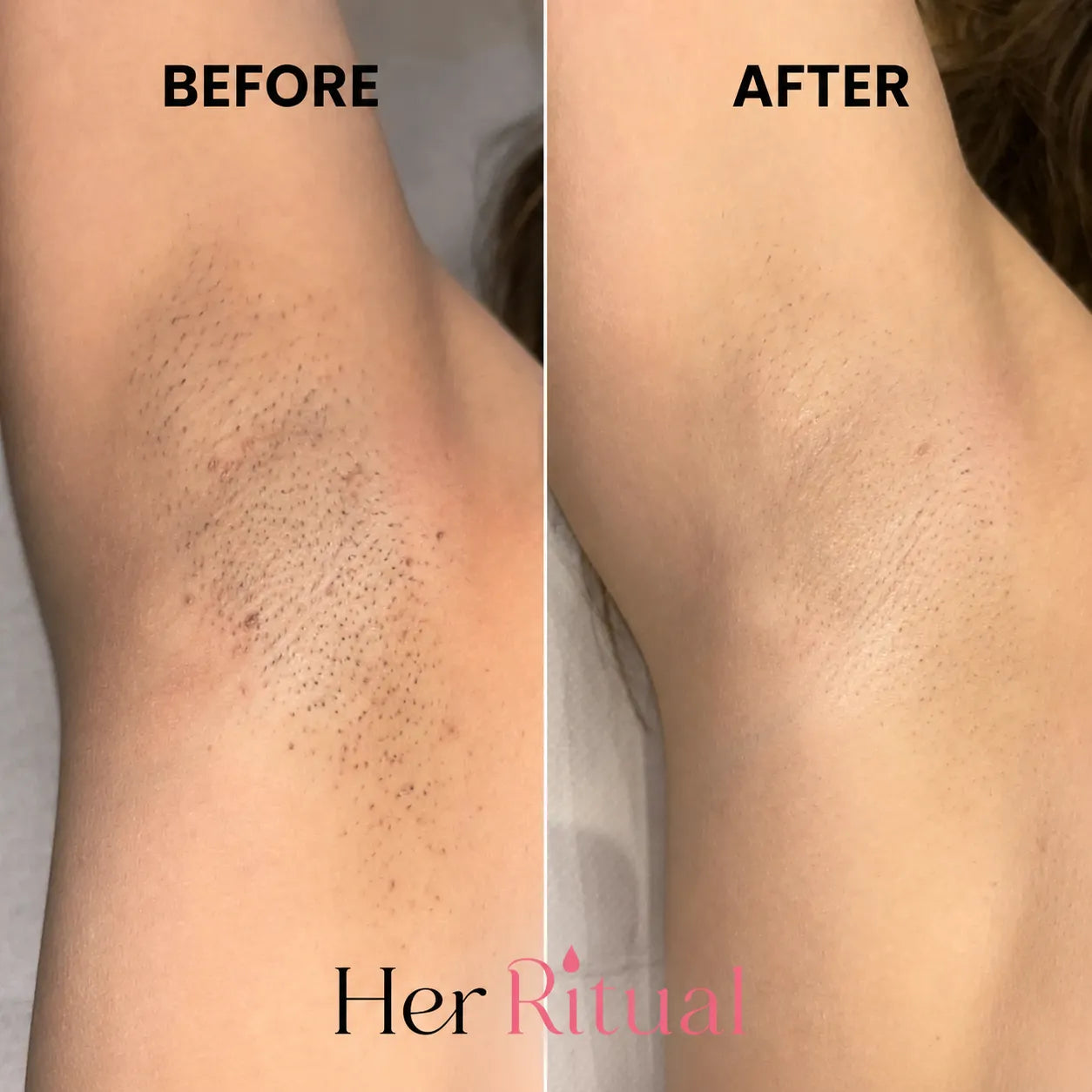 Her Ritual - Hair Inhibitor Oil™