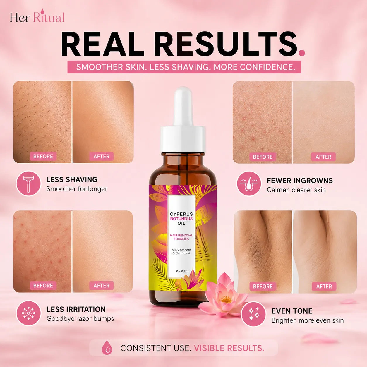 Her Ritual - Hair Inhibitor Oil™