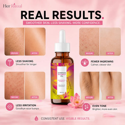 Her Ritual - Hair Inhibitor Oil™