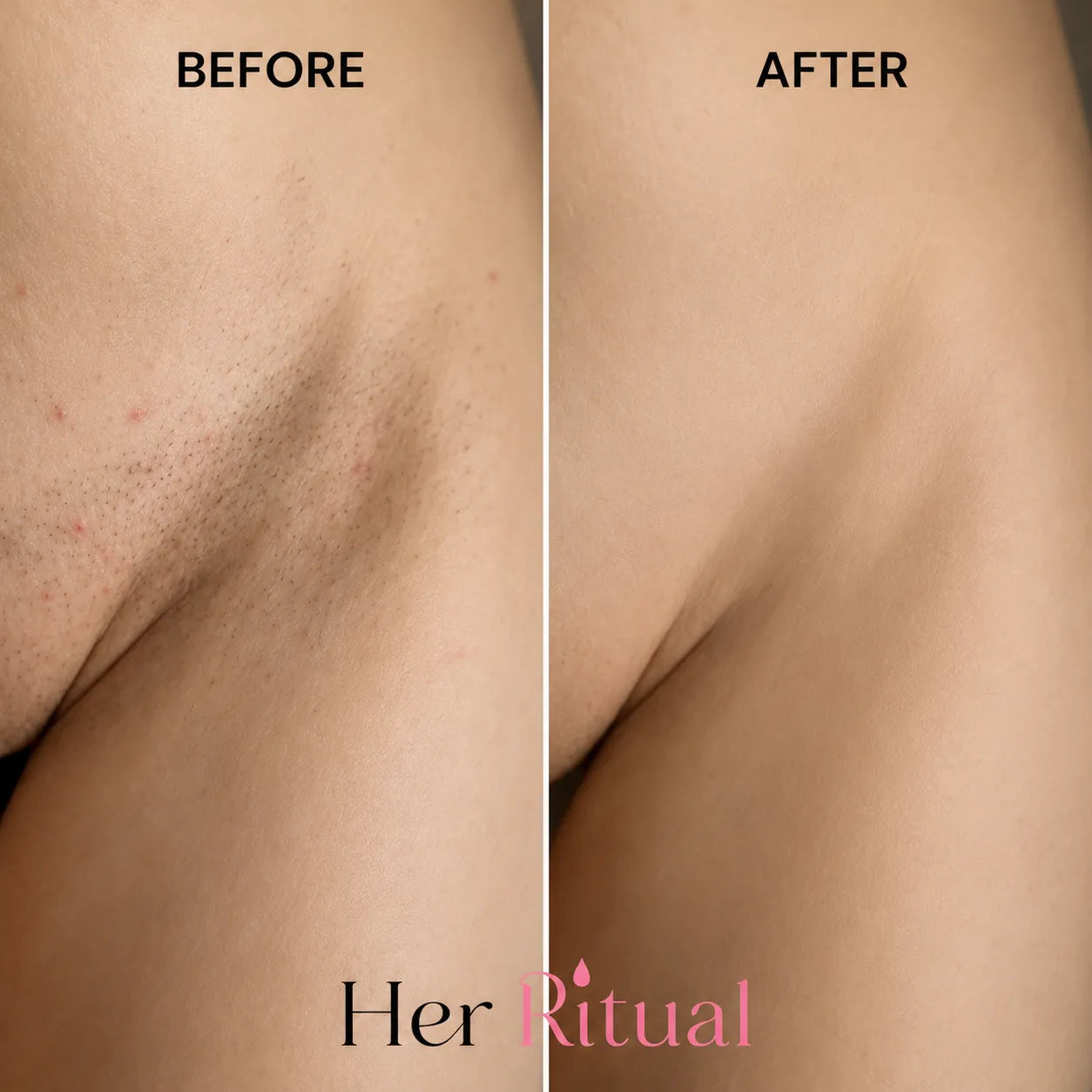 Her Ritual - Hair Inhibitor Oil™
