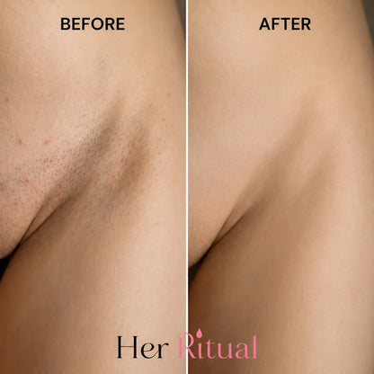 Her Ritual - Hair Inhibitor Oil™